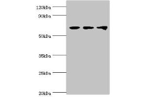 Western blot All lanes: Probable ATP-dependent RNA helicase DDX5 antibody at 3 μg/mL Lane 1: NIH/3T3 whole cell lysate Lane 2: Hela whole cell lysate Lane 3: 293T whole cell lysate Secondary Goat polyclonal to rabbit IgG at 1/10000 dilution Predicted band size: 70, 61 kDa Observed band size: 70 kDa (DDX5 anticorps  (AA 1-290))