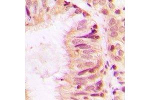 Immunohistochemistry (IHC) image for anti-Serpin Family H Member 1 (SERPINH1) antibody (ABIN7308322) (SERPINH1 anticorps)