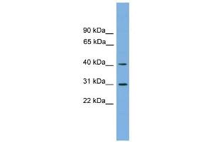 HSD3B7 antibody used at 1 ug/ml to detect target protein.