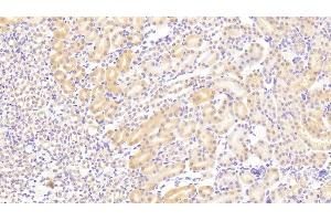 Detection of VCL in Mouse Kidney Tissue using Polyclonal Antibody to Vinculin (VCL)