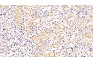 Detection of VCL in Mouse Kidney Tissue using Polyclonal Antibody to Vinculin (VCL) (Vinculin anticorps  (AA 879-1064))