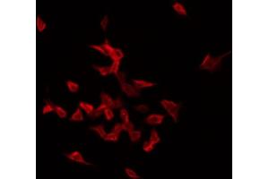 ABIN6272428 staining Hela by IF/ICC. (Septin 1 anticorps  (Internal Region))