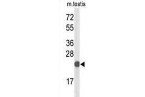Western blot analysis of CXXC4 Antibody in mouse testis tissue lysates (35ug/lane).