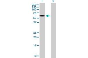 Western Blot analysis of ERCC6L expression in transfected 293T cell line by ERCC6L MaxPab polyclonal antibody.