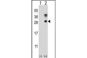 Western blot analysis of KLK7 (arrow) using rabbit polyclonal KLK7 Antibody  (ABIN652198 and ABIN2840744).