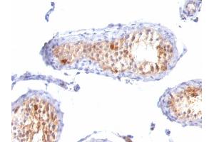 Formalin-fixed, paraffin-embedded human Testis stained with MART-1 / Melan-A Monoclonal Antibody (A103+M2-7C10+M2-9E3). (MLANA anticorps)