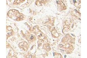 Immunohistochemical staining of formalin-fixed paraffin-embedded human fetal liver tissue showing membrane staining with AGPS polyclonal antibody  at 1 : 100 dilution.