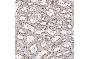Immunohistochemical staining (Formalin-fixed paraffin-embedded sections) of human kidney with NR4A2 polyclonal antibody  shows moderate membranous and nuclear positivity in cells in tubules.