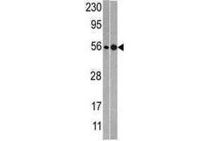Image no. 1 for anti-60S Ribosomal Export Protein NMD3 (NMD3) (C-Term) antibody (ABIN357284) (NMD3 anticorps  (C-Term))