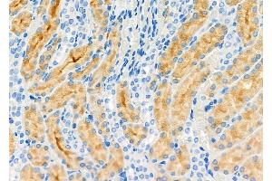 ABIN6258028 and ABIN6274976 at 1/100 staining Rat kidney tissue by IHC-P. (COMT anticorps  (N-Term))