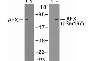 Western blot analysis of extracts from 293 cells using AFX (Ab-197) antibody (Line 1 and 2) and AFX (phospho-Ser197) antibody (Line 3 and 4). (FOXO4 anticorps  (pSer197))