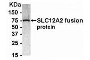 Western Blotting (WB) image for anti-Solute Carrier Family 12 (Potassium-Chloride Transporter) Member 2 (SLC12A2) (AA 800-1000) antibody (ABIN2468175) (SLC12A2 anticorps  (AA 800-1000))