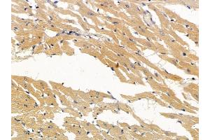 ABIN6256960 and ABIN6274918 at 1/100 staining rat heart tissue by IHC-P. (BMP10 anticorps  (Internal Region))