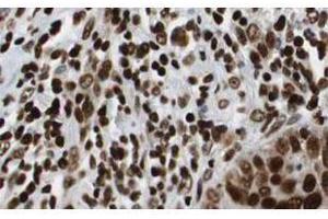 Immunohistochemistry of Rabbit Anti-HDAC-1 Antibody.