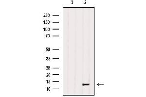 Western blot analysis of extracts from Hela, using PPP1R1C Antibody. (PPP1R1C anticorps  (Internal Region))