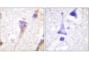 Immunohistochemistry analysis of paraffin-embedded human brain tissue, using PKD1/PKC mu (Ab-463) Antibody. (PKC mu anticorps  (AA 429-478))