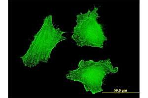 Immunofluorescence of monoclonal antibody to DLX5 on HeLa cell. (DLX5 anticorps  (AA 1-110))