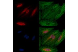ABIN6257344 and ABIN6274221 staining  cells by IF/ICC. (MZF1 anticorps  (N-Term))