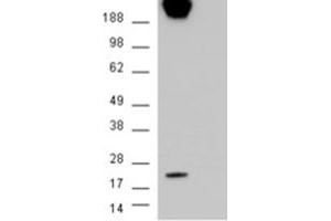 Image no. 3 for anti-Caveolin 1, Caveolae Protein, 22kDa (CAV1) (Internal Region) antibody (ABIN374578) (Caveolin-1 anticorps  (Internal Region))