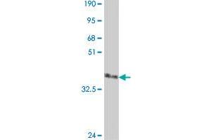 Western Blot detection against Immunogen (37.