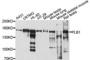 Western blot analysis of extracts of various cell lines, using PLB1 antibody. (Phospholipase B anticorps  (AA 1110-1415))