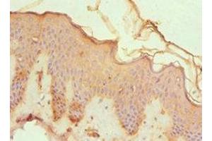 Immunohistochemistry of paraffin-embedded human skin tissue using ABIN7148815 at dilution of 1:100 (CREB3 anticorps  (AA 1-230))