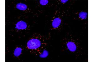 Proximity Ligation Analysis of protein-protein interactions between PDGFRB and PLCG1.