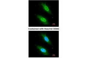 ICC/IF Image Immunofluorescence analysis of paraformaldehyde-fixed HeLa, using CARD8, antibody at 1:200 dilution. (CARD8 anticorps  (C-Term))
