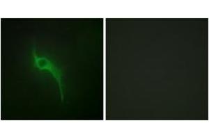 Immunofluorescence analysis of HeLa cells, using Collagen V alpha1 Antibody. (COL5A1 anticorps  (AA 301-350))
