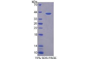 SDS-PAGE (SDS) image for Prokineticin 2 (PROK2) (AA 30-128) protein (His tag,GST tag) (ABIN3209865)