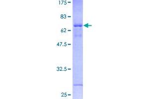 Image no. 1 for DPH1 Homolog (DPH1) (AA 1-363) protein (GST tag) (ABIN1351928)