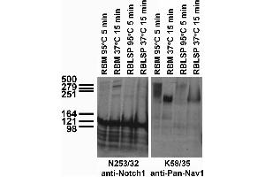 Immunoblot versus extracts of heart tissue from WT and SUR2 KO mice probed with N319A/14 TC supe.