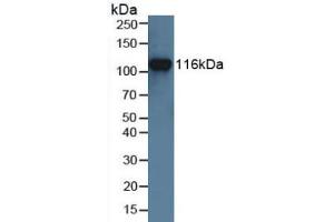 Figure. (MUSK anticorps  (AA 517-777))