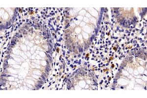 Detection of PD1 in Human Appendix Tissue using Polyclonal Antibody to Programmed Cell Death Protein 1 (PD1) (PD-1 anticorps  (AA 41-132))
