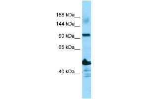 WB Suggested Anti-ADAMTS14 Antibody Titration: 1. (ADAMTS14 anticorps  (N-Term))