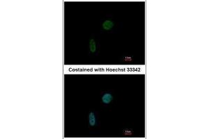 ICC/IF Image Immunofluorescence analysis of paraformaldehyde-fixed HeLa, using CIZ1, antibody at 1:200 dilution.
