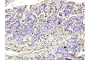 Formalin-fixed and paraffin embedded rat colitis tissue labeled with Rabbit Anti-Podoplanin/gp36 Polyclonal Antibody (ABIN736896), Unconjugated 1:200 followed by conjugation to the secondary antibody and DAB staining (Podoplanin anticorps  (AA 91-166))