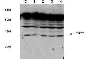 anti-cdc2 Cyclin Dependent Kinase  was used to detect human p34cdc2by western blot in untreated (Contol) and drug treated lysates of MCF-7 cells. (CDK5 anticorps)