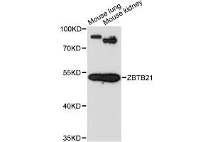 Western blot analysis of extracts of various cell lines, using ZBTB21 antibody (ABIN6291079) at 1:3000 dilution. (ZNF295 anticorps)