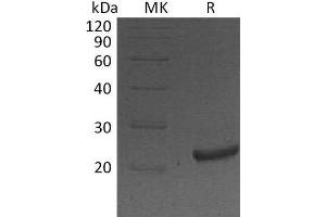 Western Blotting (WB) image for Lipocalin 2 (LCN2) protein (His tag) (ABIN7320752) (Lipocalin 2 Protein (LCN2) (His tag))