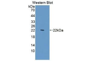 Detection of Recombinant PDCD6, Human using Polyclonal Antibody to Programmed Cell Death Protein 6 (PDCD6)