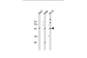 All lanes : Anti-CCT8L2 Antibody (C-Term) at 1:2000 dilution Lane 1: A431 whole cell lysate Lane 2: Hela whole cell lysate Lane 3: PC-3 whole cell lysate Lysates/proteins at 20 μg per lane. (CCT8L2 anticorps  (AA 511-542))
