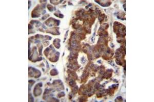 Formalin fixed and paraffin embedded human pancreas tissue reacted with Dermatopontin Antibody (N-term) followed by peroxidase conjugation of the secondary antibody and DAB staining.