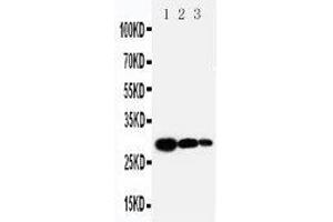 Anti-TIMP1 antibody, Western blotting Lane 1: Recombinant Human TIMP-1 Protein 10ng Lane 2: Recombinant Human TIMP-1 Protein 5ng Lane 3: Recombinant Human TIMP-1 Protein 2. (TIMP1 anticorps  (C-Term))