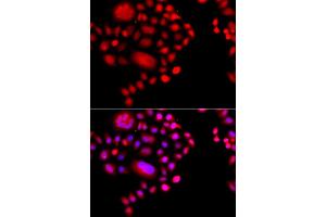 Immunofluorescence analysis of A549 cell using POLR1D antibody. (POLR1D anticorps)
