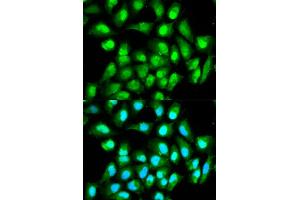 Immunofluorescence analysis of HeLa cell using RAN antibody.