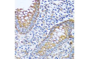 Immunohistochemistry of paraffin-embedded human appendix using  antibody (ABIN7265428) at dilution of 1:100 (40x lens).