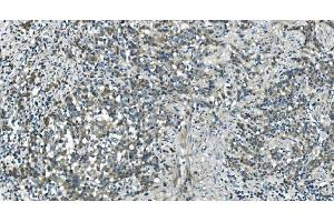 IHC analysis of CDC123 using anti-CDC123 antibody (ABIN7599284). (CDC123 anticorps  (AA 1-336))