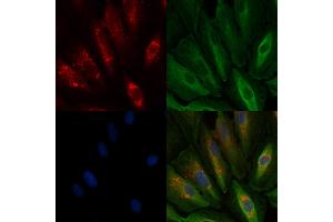 ABIN6259993 and ABIN6278082 staining  cells by IF/ICC. (Apolipoprotein D anticorps  (Internal Region))