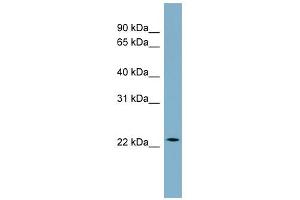 WB Suggested Anti-CCDC25 Antibody Titration: 0. (CCDC25 anticorps  (Middle Region))
